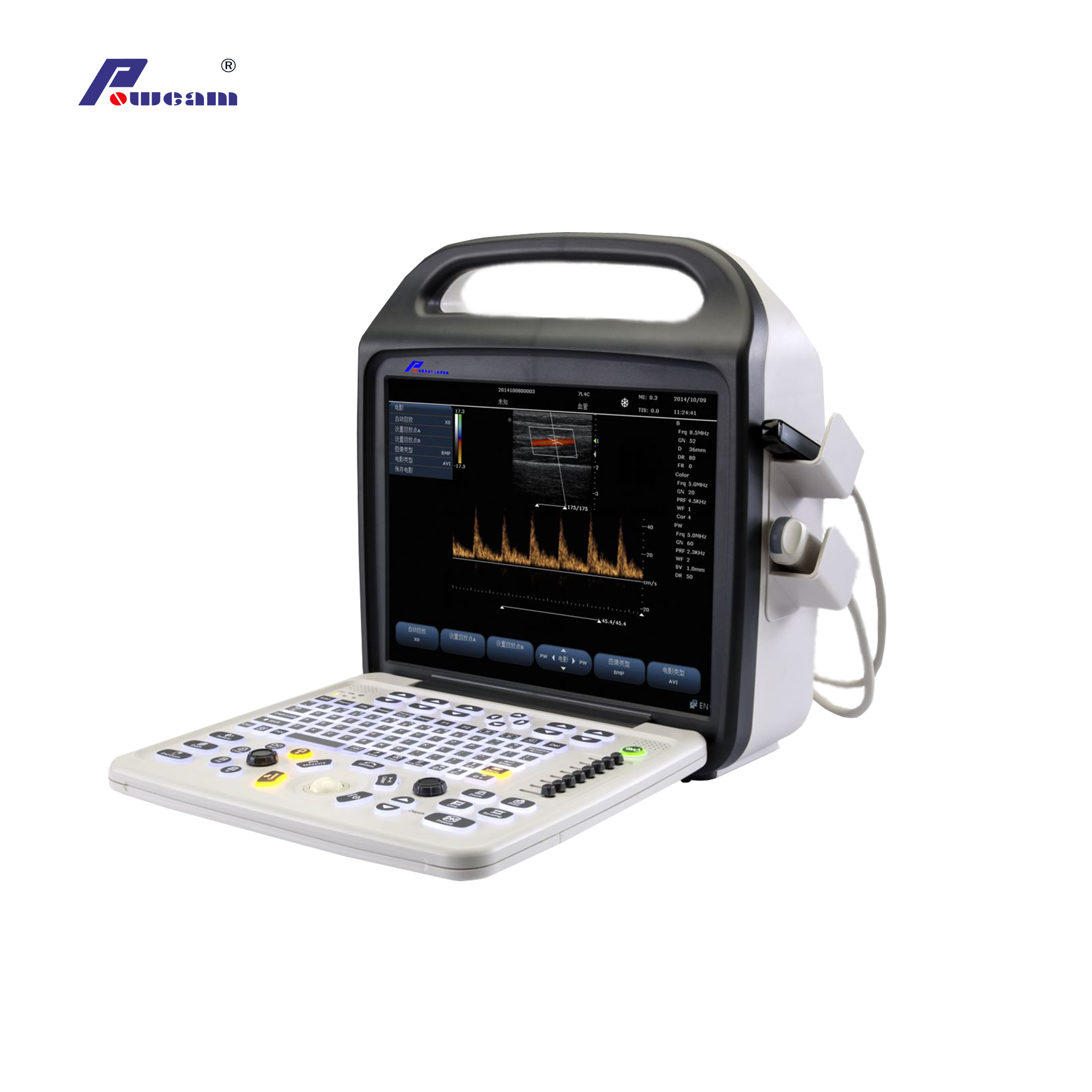 Escáner de ultrasonido Doppler de color ultrasonido portátil (C10)