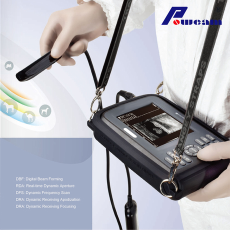 Escáner de ultrasonido de mano hospitalario (WHYB4000)