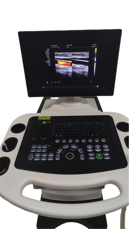  Ultrasonido Doppler de color física
