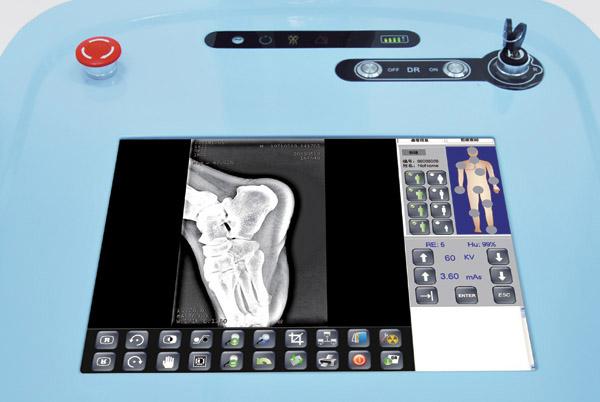 Sistema de radiografía digital móvil de alta frecuencia DR200