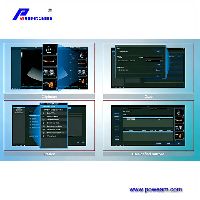 Sistema de diagnóstico Doppler color de alto rendimiento para imágenes clínicas