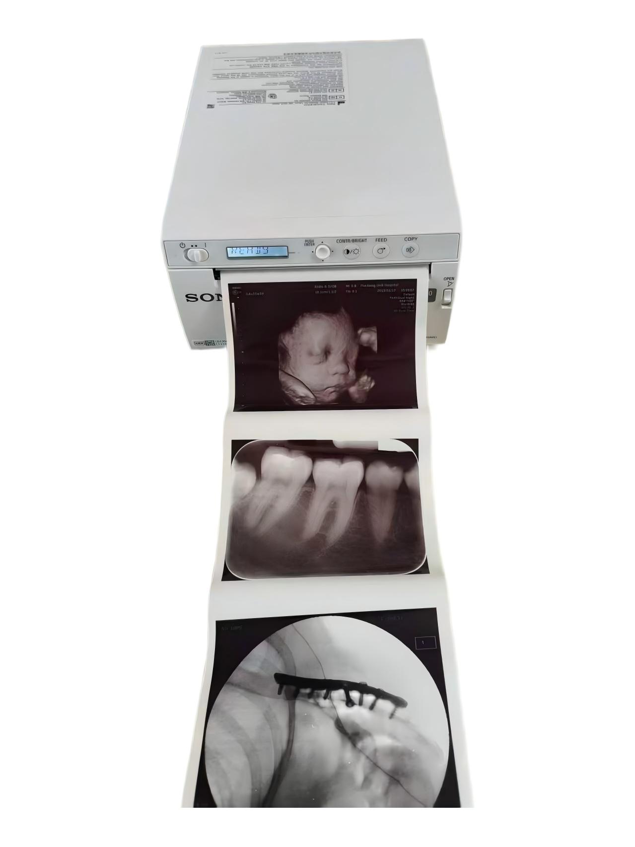 Impresora gráfica térmica híbrida en blanco y negro digital con imagen de ultrasonido up-X899MD