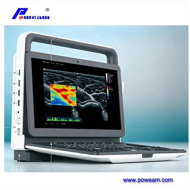 Sistema de diagnóstico Doppler color de alto rendimiento para imágenes clínicas