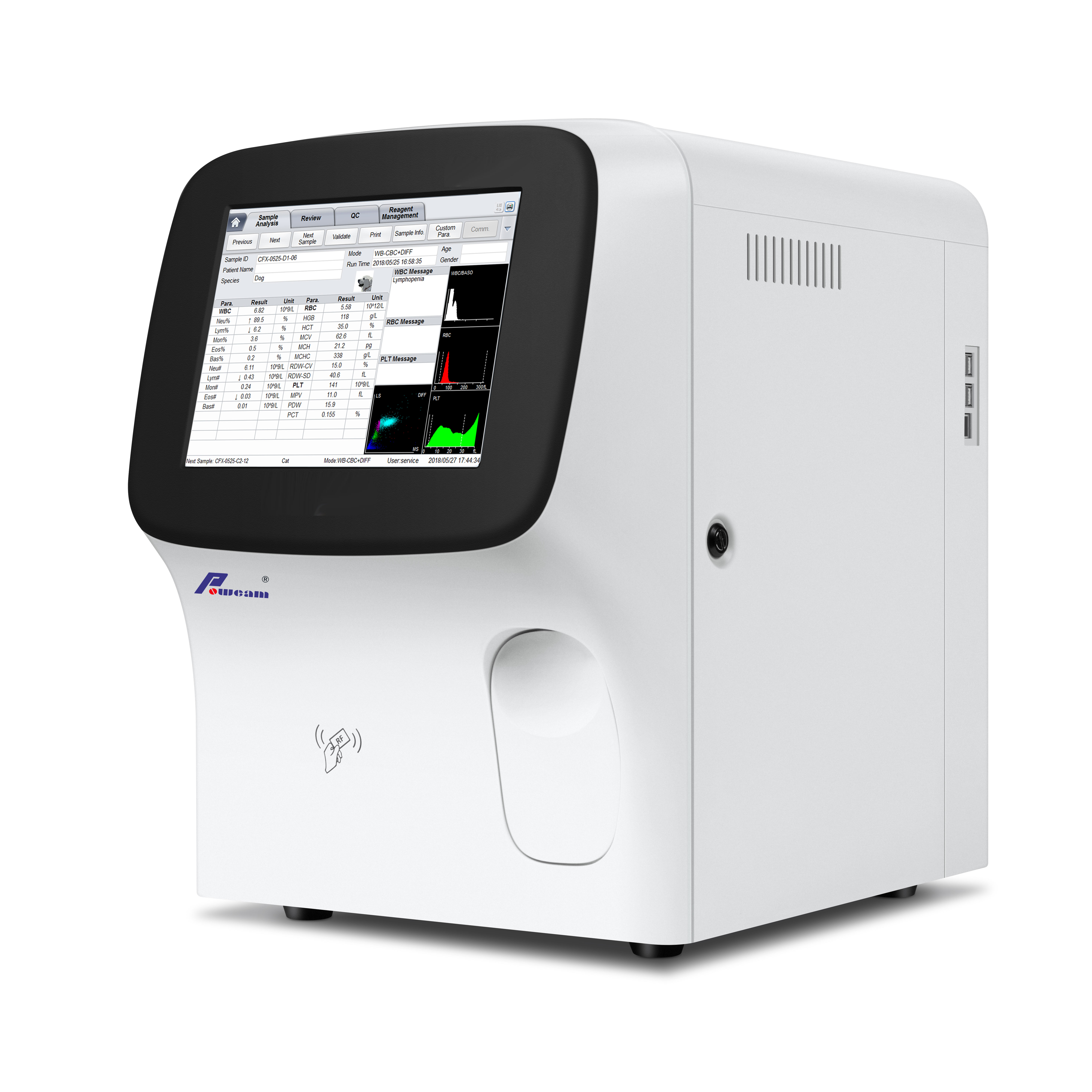 Analizador de hematología automática de 5 partes para el analizador de hematología VET