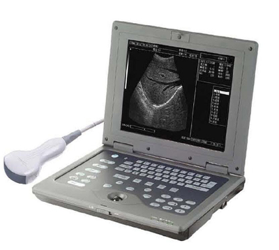 Instrumentos médicos de ultrasonido Máquina de ultrasonido portátil B / W Escáner de ultrasonido digital portátil