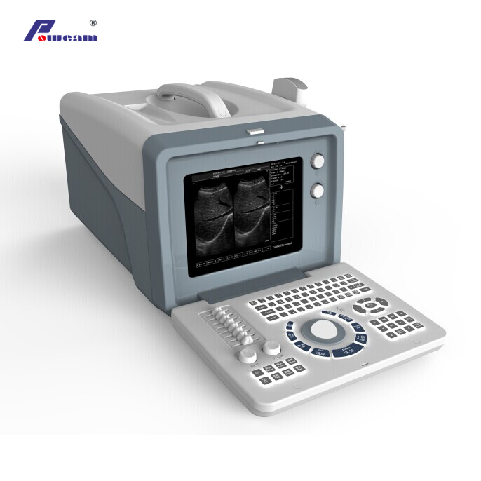 Escáner de ultrasonido portátil digital médico aprobado por CE (WHYC6)