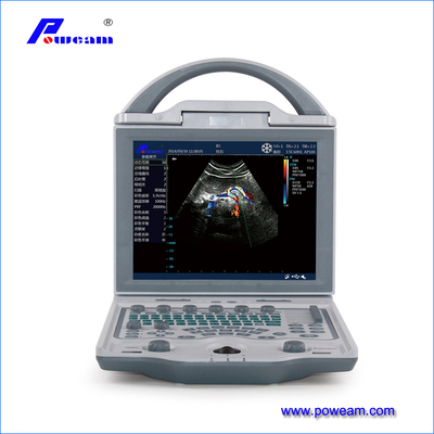 2021 escáner de ultrasonido Doppler de color digital portátil de China