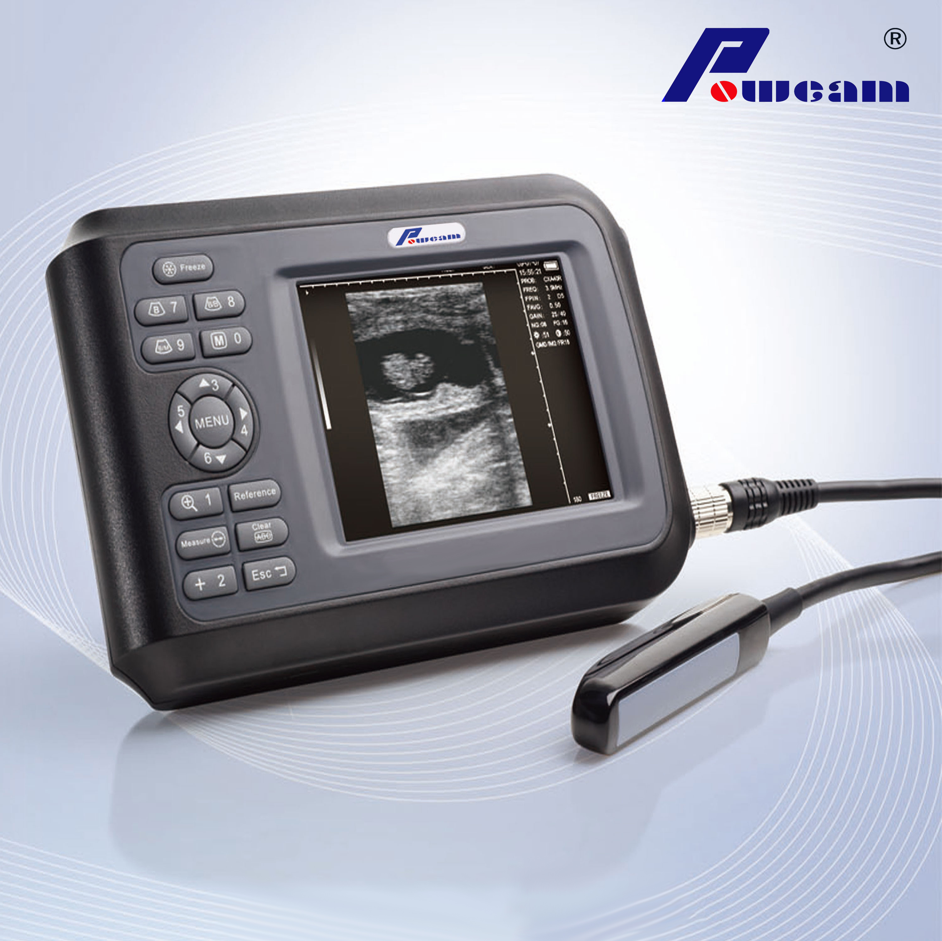 CE Veterinary Digital Portable Portable Scanner Scanner (WHYB4000)